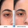 antes e depois serum lifting de olhos