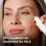 clareou as manchas da pele